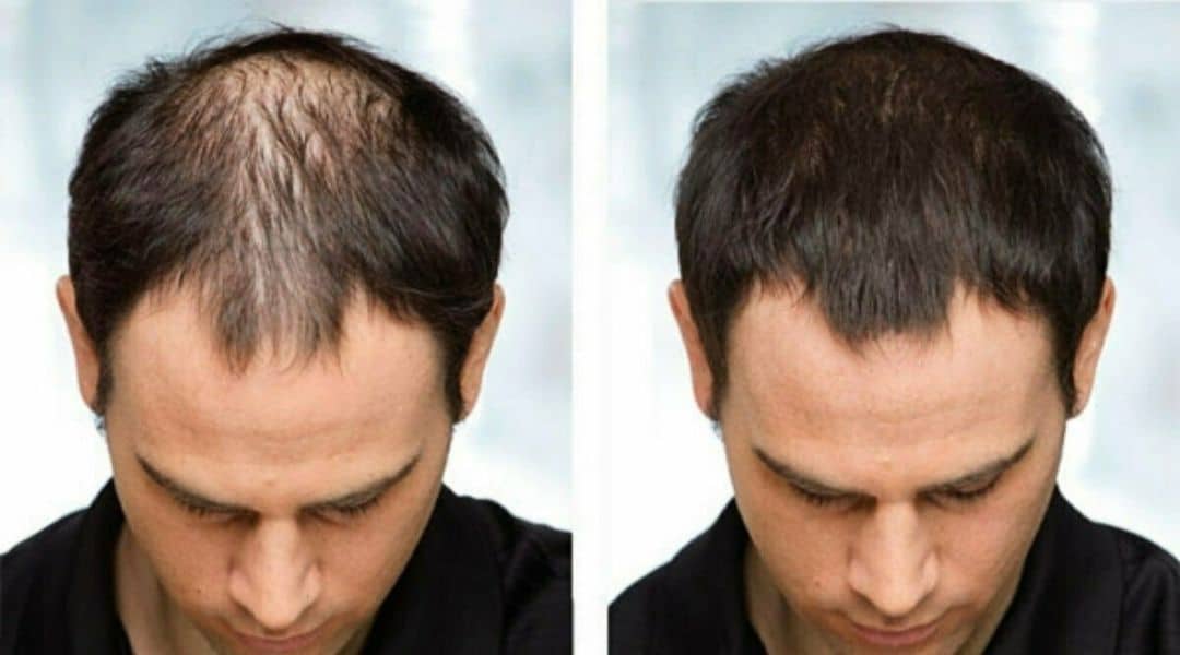 Risultato Esocrease — Giorgio, 43 anni