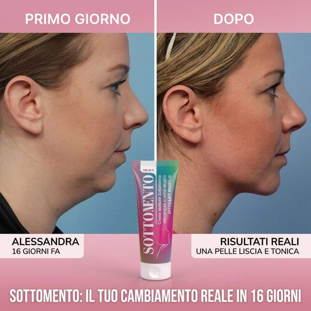 Come Applicare Sottomento
