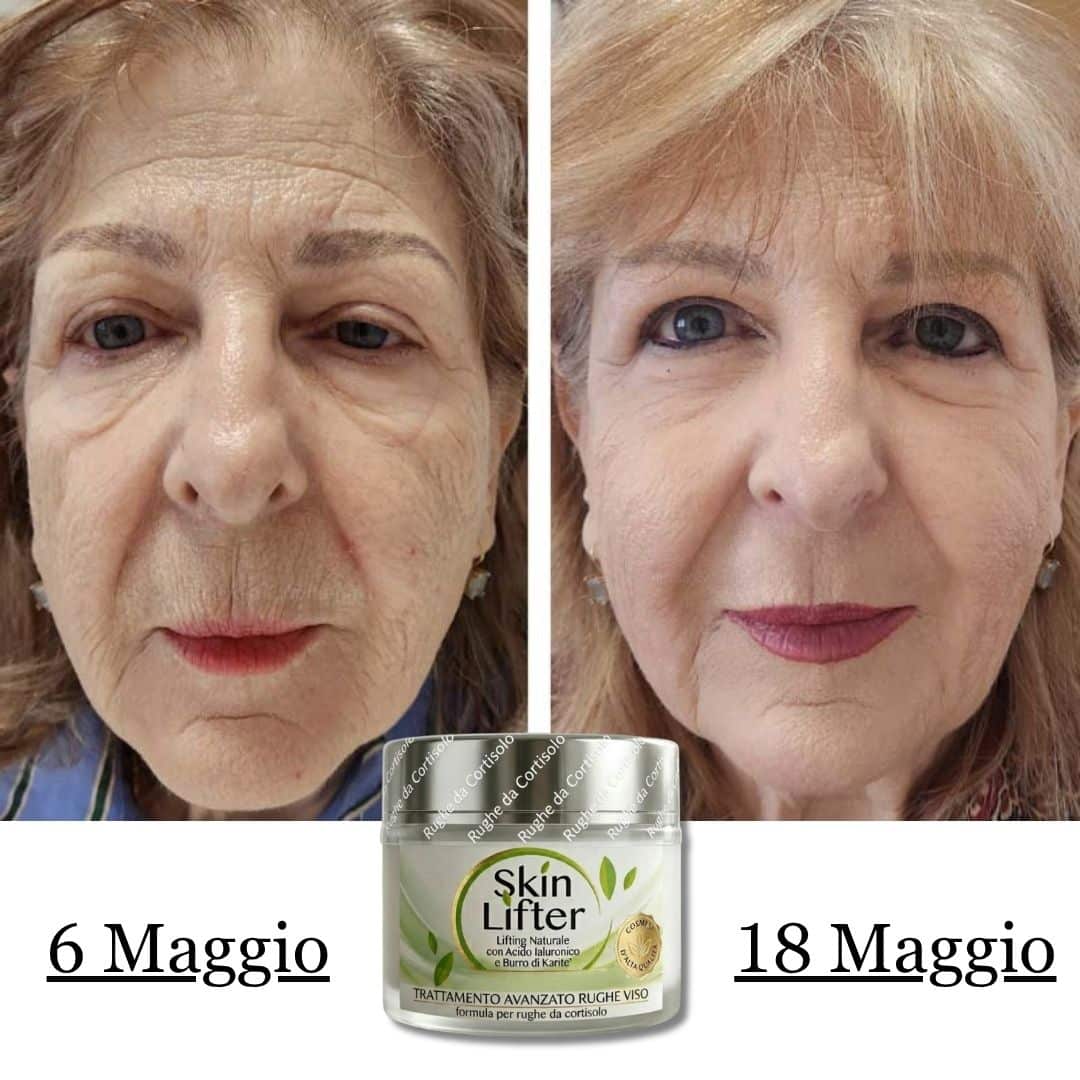 Skin Lifter crema