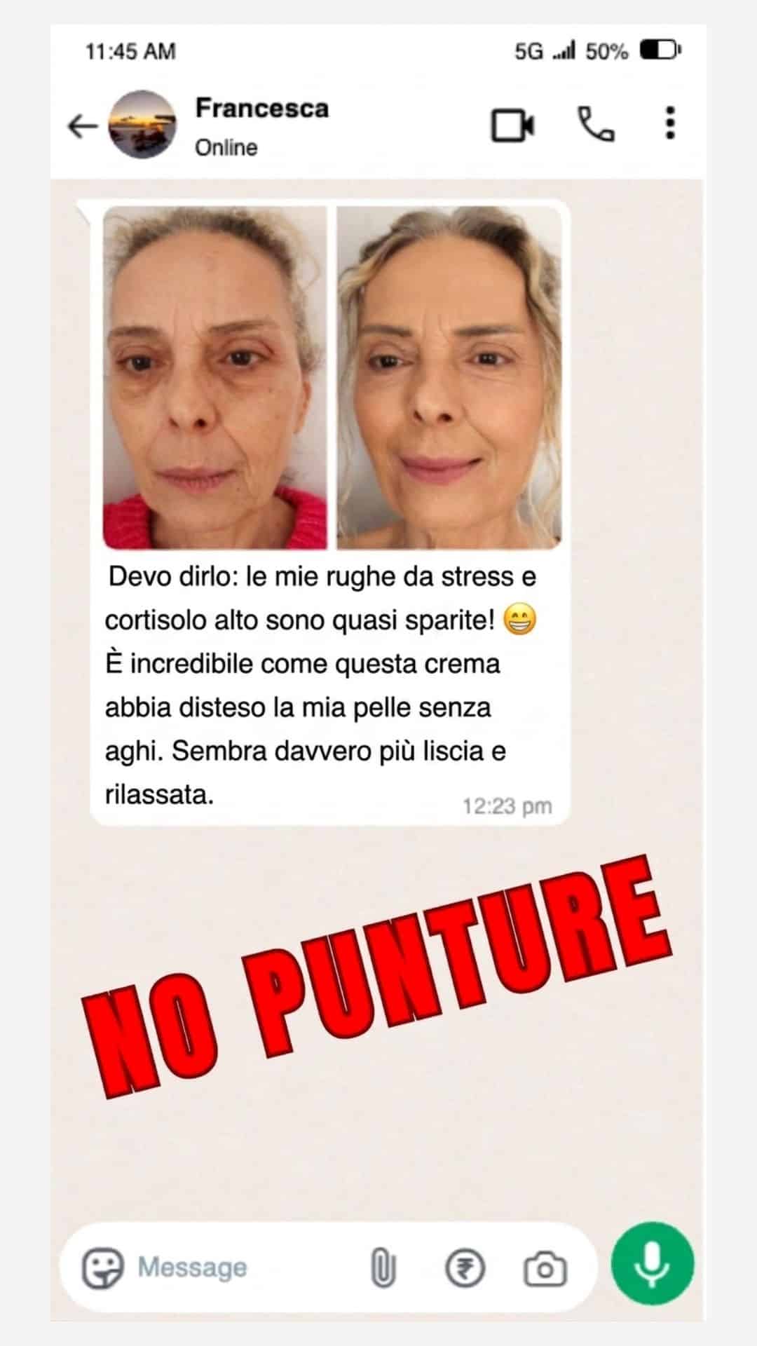 Skin Lifter risultato