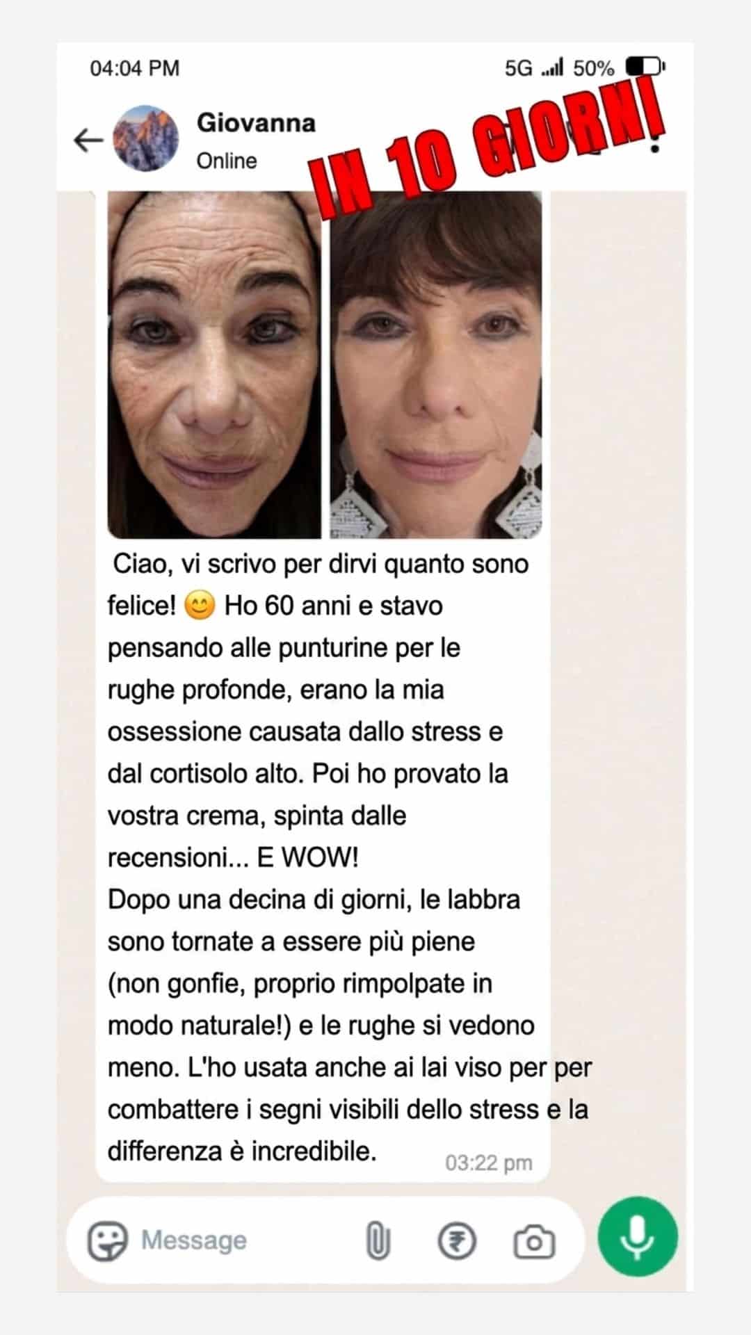 Skin Lifter risultato