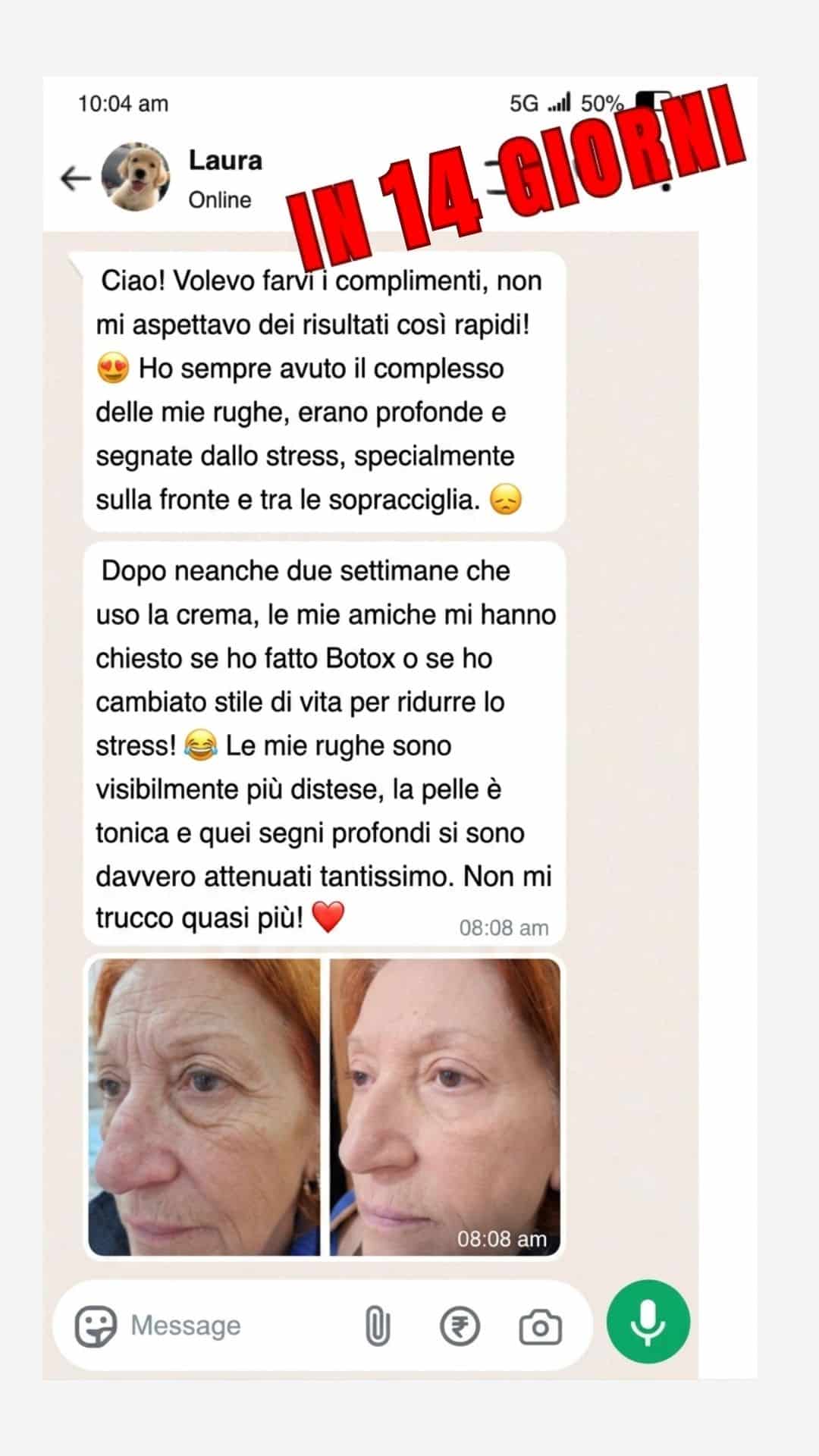 Skin Lifter risultato
